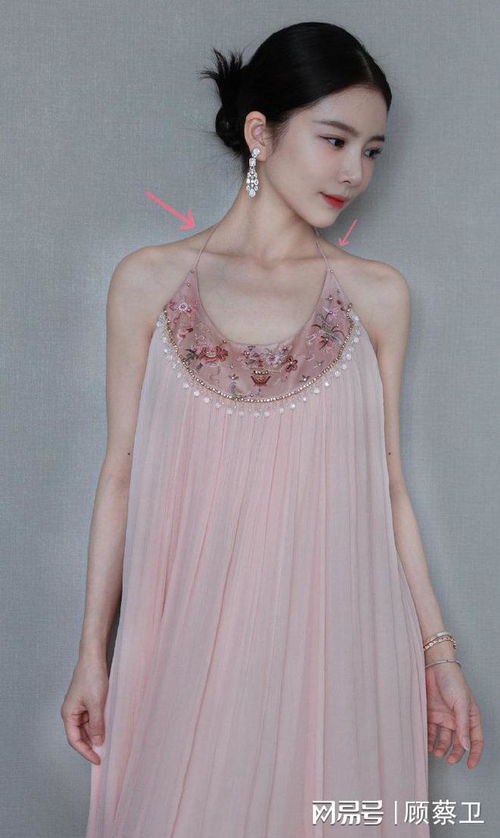 杜淳妻子做医美过敏
