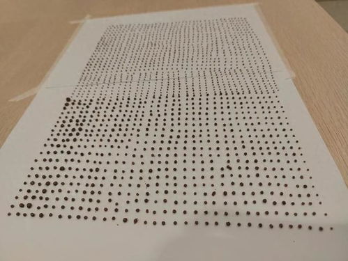 大爷体内1791颗结石
