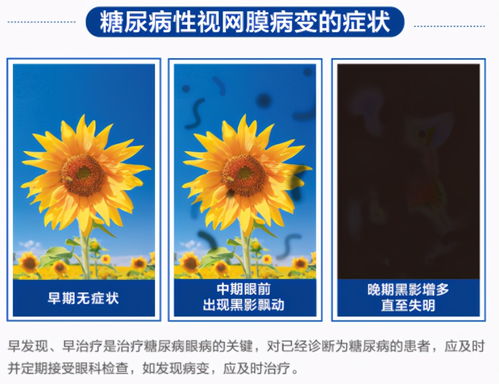 7岁女孩视力降至0.2 7岁女孩视力降至0.2