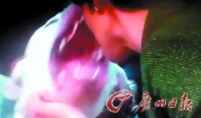 男子咬伤女主播的嘴