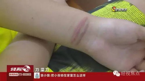 少女的伤痕，吸毒后的割腕自白